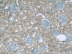 GRB10 Rabbit anti-Human, Mouse, Rat, Polyclonal, Proteintech 150 &mu;L;