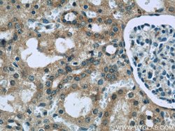 GRB10 Rabbit anti-Human, Mouse, Rat, Polyclonal, Proteintech 150 &mu;L;