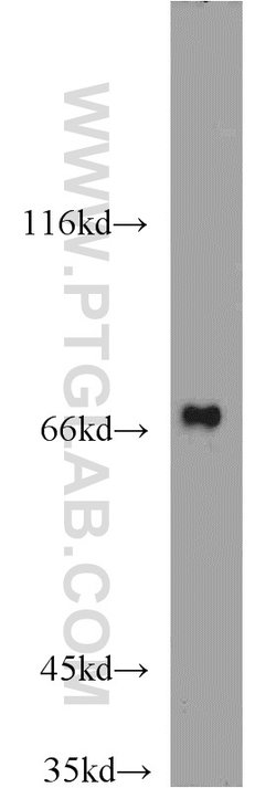 GRB10 Rabbit anti-Human, Mouse, Rat, Polyclonal, Proteintech 150 &mu;L;