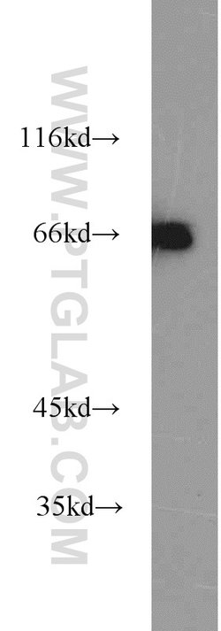 GRB10 Rabbit anti-Human, Mouse, Rat, Polyclonal, Proteintech 150 &mu;L;
