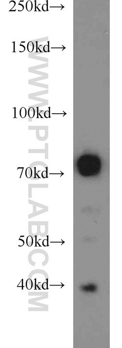 GRB10 Rabbit anti-Human, Mouse, Rat, Polyclonal, Proteintech 150 &mu;L;