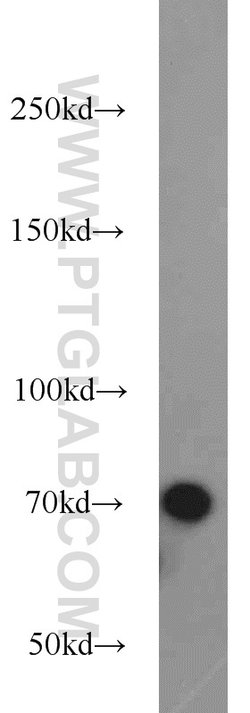 GRB10 Rabbit anti-Human, Mouse, Rat, Polyclonal, Proteintech 150 &mu;L;