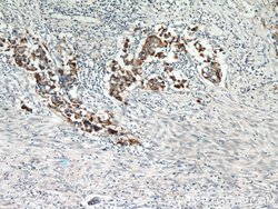 MUC1/CA15-3 Rabbit anti-Human, Polyclonal, Proteintech 150 &mu;L; Unconjugated:Antibodies,