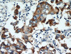 MUC1/CA15-3 Rabbit anti-Human, Polyclonal, Proteintech 150 &mu;L; Unconjugated:Antibodies,