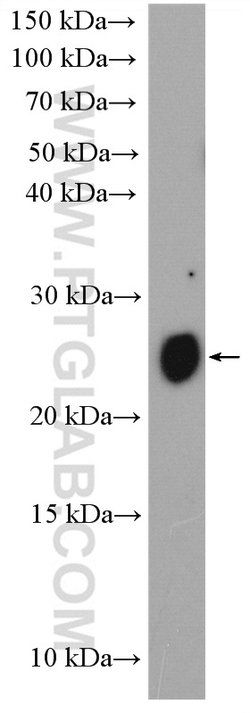 MUC1/CA15-3 Rabbit anti-Human, Polyclonal, Proteintech 150 &mu;L; Unconjugated:Antibodies,