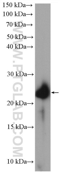 MUC1/CA15-3 Rabbit anti-Human, Polyclonal, Proteintech 150 &mu;L; Unconjugated:Antibodies,