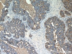 MUC1/CA15-3 Rabbit anti-Human, Polyclonal, Proteintech 150 &mu;L; Unconjugated:Antibodies,