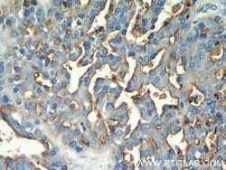 MUC1/CA15-3 Rabbit anti-Human, Polyclonal, Proteintech 150 &mu;L; Unconjugated:Antibodies,