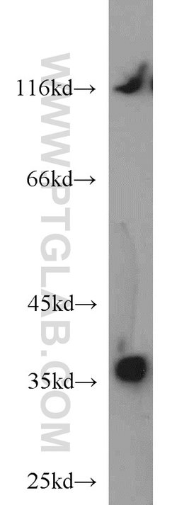 P15RS Rabbit anti-Human, Mouse, Polyclonal, Proteintech:Antibodies:Primary