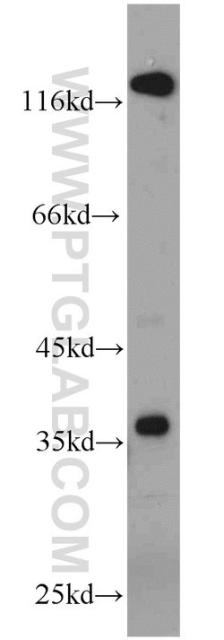 P15RS Rabbit anti-Human, Mouse, Polyclonal, Proteintech:Antibodies:Primary