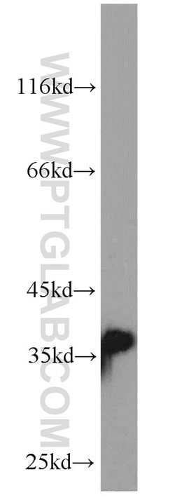 P15RS Rabbit anti-Human, Mouse, Polyclonal, Proteintech:Antibodies:Primary