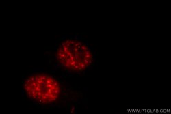 P15RS Rabbit anti-Human, Mouse, Polyclonal, Proteintech:Antibodies:Primary