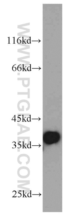 P15RS Rabbit anti-Human, Mouse, Polyclonal, Proteintech:Antibodies:Primary