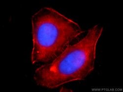 alpha Actin Rabbit anti-Human, Mouse, Rat, Polyclonal, Proteintech 150