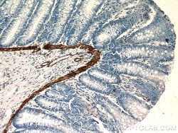 alpha Actin Rabbit anti-Human, Mouse, Rat, Polyclonal, Proteintech 150
