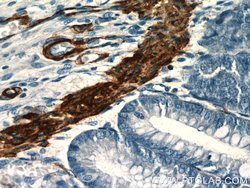 alpha Actin Rabbit anti-Human, Mouse, Rat, Polyclonal, Proteintech 150