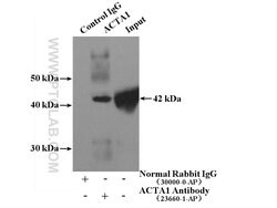 alpha Actin Rabbit anti-Human, Mouse, Rat, Polyclonal, Proteintech 150