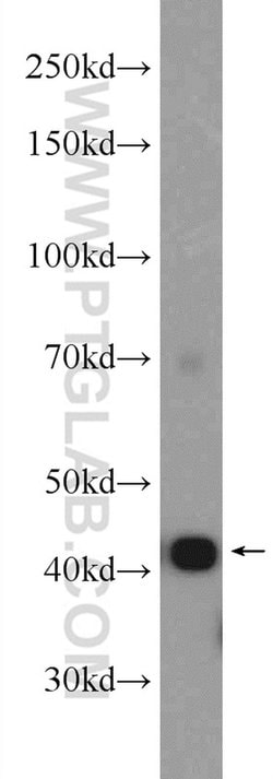 alpha Actin Rabbit anti-Human, Mouse, Rat, Polyclonal, Proteintech 150