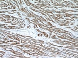 alpha Actin Rabbit anti-Human, Mouse, Rat, Polyclonal, Proteintech 150