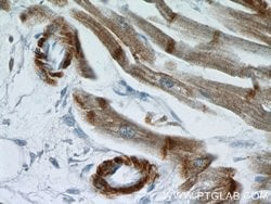 alpha Actin Rabbit anti-Human, Mouse, Rat, Polyclonal, Proteintech 150