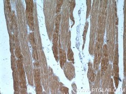 alpha Actin Rabbit anti-Human, Mouse, Rat, Polyclonal, Proteintech 150