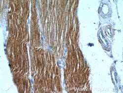 alpha Actin Rabbit anti-Human, Mouse, Rat, Polyclonal, Proteintech 150