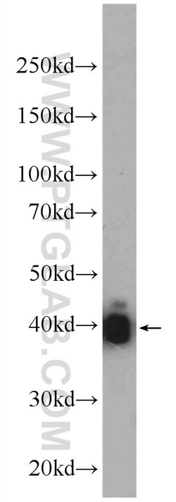 alpha Actin Rabbit anti-Human, Mouse, Rat, Polyclonal, Proteintech 150
