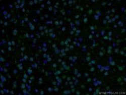RSK2 Rabbit anti-Human, Mouse, Polyclonal, Proteintech:Antibodies:Primary