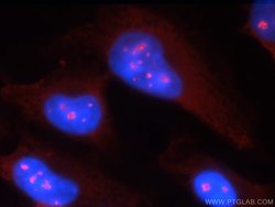 RSK2 Rabbit anti-Human, Mouse, Polyclonal, Proteintech:Antibodies:Primary