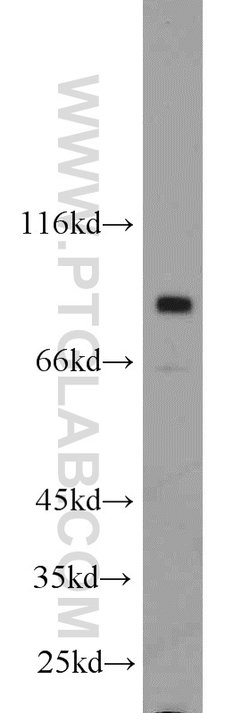 RSK2 Rabbit anti-Human, Mouse, Polyclonal, Proteintech:Antibodies:Primary