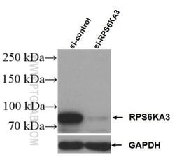 RSK2 Rabbit anti-Human, Mouse, Polyclonal, Proteintech:Antibodies:Primary