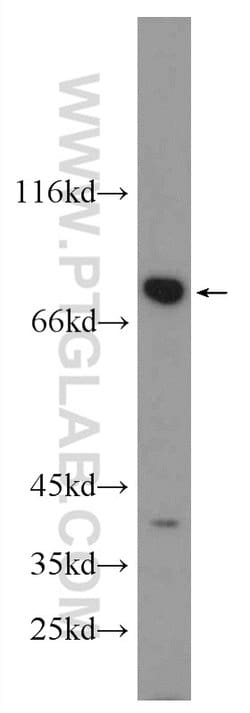 RSK2 Rabbit anti-Human, Mouse, Polyclonal, Proteintech:Antibodies:Primary