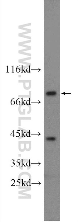 RSK2 Rabbit anti-Human, Mouse, Polyclonal, Proteintech:Antibodies:Primary