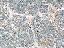 ADAM8 Rabbit anti-Human, Mouse, Polyclonal, Proteintech 150 &mu;L | Buy Online | Proteintech Group Inc | Fisher Scientific