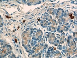 ADAM8 Rabbit anti-Human, Mouse, Polyclonal, Proteintech 150 &mu;L | Buy Online | Proteintech Group Inc | Fisher Scientific