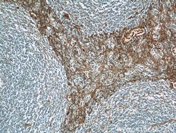 ADAM8 Rabbit anti-Human, Mouse, Polyclonal, Proteintech 150 &mu;L | Buy Online | Proteintech Group Inc | Fisher Scientific