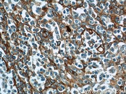 ADAM8 Rabbit anti-Human, Mouse, Polyclonal, Proteintech 150 &mu;L | Buy Online | Proteintech Group Inc | Fisher Scientific