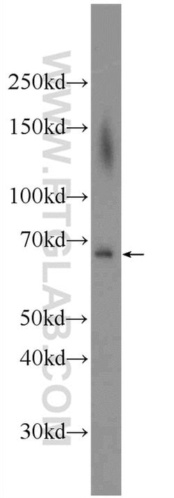 ADAM8 Rabbit anti-Human, Mouse, Polyclonal, Proteintech 150 &mu;L | Buy Online | Proteintech Group Inc | Fisher Scientific