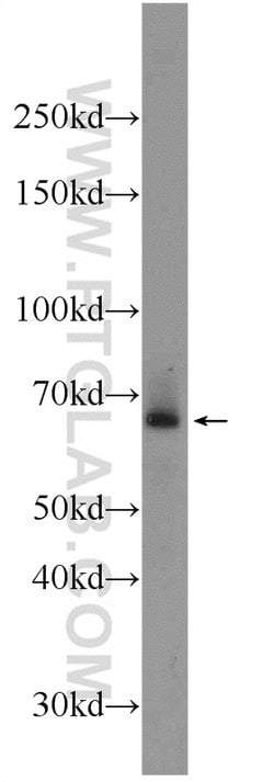 ADAM8 Rabbit anti-Human, Mouse, Polyclonal, Proteintech 150 &mu;L | Buy Online | Proteintech Group Inc | Fisher Scientific
