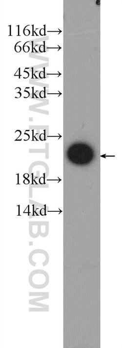 FATE1 Rabbit anti-Human, Mouse, Polyclonal, Proteintech 150 &mu;L; Unconjugated:Antibodies,