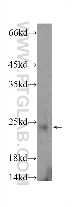 FATE1 Rabbit anti-Human, Mouse, Polyclonal, Proteintech 150 &mu;L; Unconjugated:Antibodies,