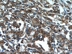 ANXA2R Rabbit anti-Human, Polyclonal, Proteintech 150 &mu;L; Unconjugated:Antibodies,