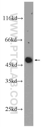 Thumbnail_ARCN1 Rabbit anti-Human, Mouse, Polyclonal, Proteintech:Antibodies:Primary