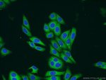 Thumbnail_ARCN1 Rabbit anti-Human, Mouse, Polyclonal, Proteintech:Antibodies:Primary