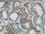 Thumbnail_ARCN1 Rabbit anti-Human, Mouse, Polyclonal, Proteintech:Antibodies:Primary