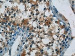 Thumbnail_ARCN1 Rabbit anti-Human, Mouse, Polyclonal, Proteintech:Antibodies:Primary