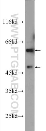 Thumbnail_ARCN1 Rabbit anti-Human, Mouse, Polyclonal, Proteintech:Antibodies:Primary