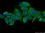 Thumbnail_NARG1 Rabbit anti-Human, Polyclonal, Proteintech 20 &mu;L; Unconjugated:Antibodies