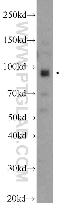 NARG1 Rabbit anti-Human, Polyclonal, Proteintech:Antibodies:Primary Antibodies