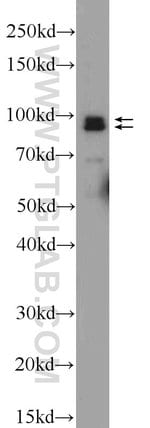 Thumbnail_NARG1 Rabbit anti-Human, Polyclonal, Proteintech 20 &mu;L; Unconjugated:Antibodies